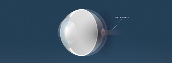 Grüner Star Sehnerv, Augenärzte Linz, Dirisamer Luft Priglinger