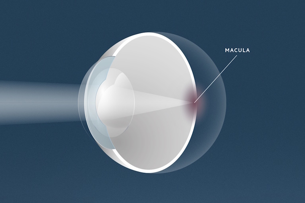 IVOM-Behandlung, Augenärzte Linz, Dirisamer Luft Priglinger