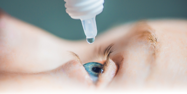 Trockenes Auge, Augenarzt Linz und Wien, Dirisamer Luft Priglinger