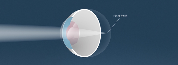 Alterssichtigkeit, Augenärzte Linz, Dirisamer Luft Priglinger