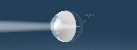 Weitsichtigkeit, Augenärzte Linz, Dirisamer Luft Priglinger