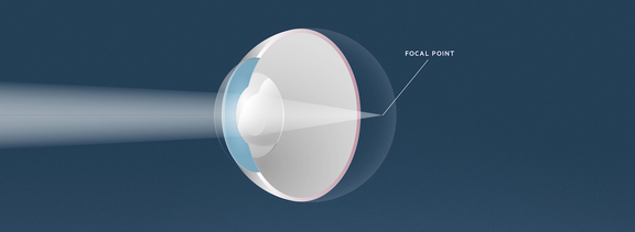 Weitsichtigkeit, Augenärzte Linz, Dirisamer Luft Priglinger