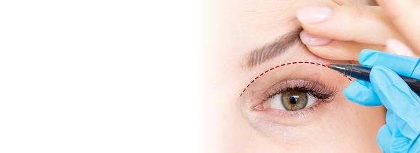 Augenlidstraffung, Augenarzt Linz und Wien, Dirisamer Luft Priglinger