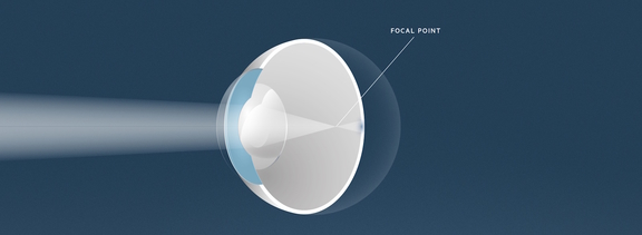 Kurzsichtigkeit, Augenärzte Linz, Dirisamer Luft Priglinger