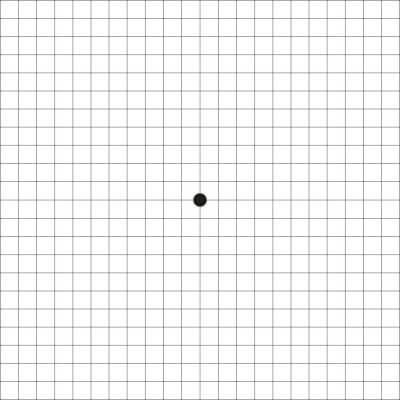 Amslertest, Augenärzte Linz, Dirisamer Luft Priglinger