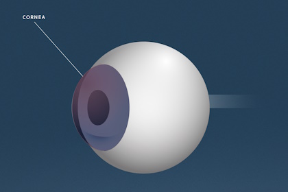 Trockenes Auge, Augenärzte Linz, Dirisamer Luft Priglinger