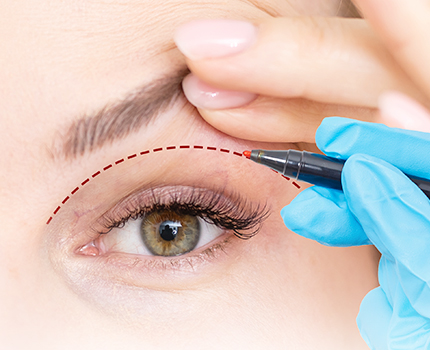 Augenlidstraffung, Augenarzt Linz und Wien, Dirisamer Luft Priglinger